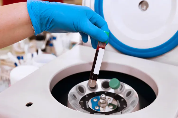 Autohemoterapie